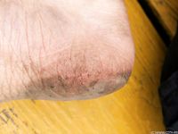 Feet - Lena G - 2011-10-31 Beauty with dirty soles