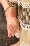 Feet - Lena H - 2018-06-04 Torn sandals
