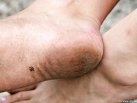 Feet - Luisa + Lena E - 2008-04-03 Naughty barefoot girls