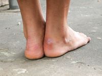 Feet - Maria D - 2014-04-04 Slender girl in shorts