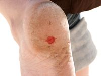 Feet - Marisha + Galya - 2007-07-31 Barefoot trips to Russian towns. Tcheboksary