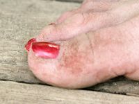 Feet - Marisha + Ksusha - 2007-06-01 Barefoot trips to Russian towns. Serpukhov