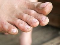 Feet - Marisha + Ksusha - 2007-06-01 Barefoot trips to Russian towns. Serpukhov