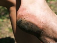 Feet - Maryana B - 2012-09-11 Hot summer midday
