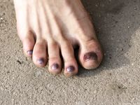 Feet - Masha A - 2011-07-14 Barefoot and happy