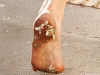 Feet - Masha A - 2011-07-14 Barefoot and happy