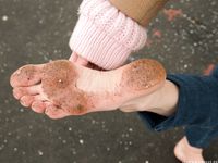 Feet - Nastya D - 2017-01-21 Cheerful barefoot girl