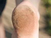 Feet - Nina - 2006-12-27 Red-haired barefoot girl