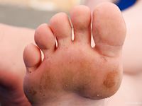 Feet - Nina - 2008-09-21 Barefoot horse riding