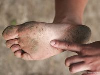 Feet - Oksana + Jenya + Anna Taradanova - 2006-12-03 Sharp exam for bare feet