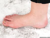 Feet - Oksana C - 2011-11-03 Hot girl on cold snow