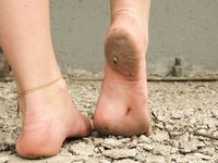 Feet - Olga E - 2014-06-18 A warm spring day