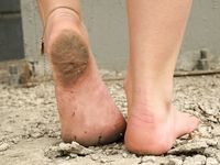 Feet - Olga E - 2014-06-18 A warm spring day