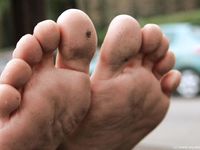 Feet - Sofia - 2008-08-14 Barefoot at home and outside