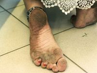 Feet - Sveta E - 2013-03-05 Gorgeous girl with tought soles