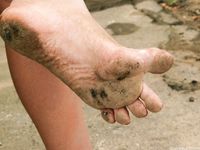 Feet - Sveta E - 2013-03-05 Gorgeous girl with tought soles