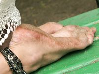 Feet - Sveta E - 2013-03-05 Gorgeous girl with tought soles