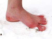 Feet - Tamara -  2009-05-27 Barefoot winter endurnce test