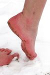 Feet - Tamara -  2009-05-27 Barefoot winter endurnce test