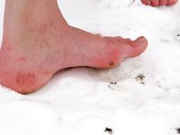 Feet - Tamara -  2009-05-27 Barefoot winter endurnce test