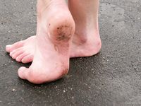 Feet - Tamara -  2009-05-27 Barefoot winter endurnce test