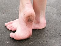 Feet - Tamara -  2009-05-27 Barefoot winter endurnce test