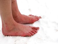 Feet - Tamara -  2009-05-27 Barefoot winter endurnce test