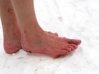 Feet - Tamara -  2009-05-27 Barefoot winter endurnce test