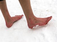 Feet - Tamara -  2009-05-27 Barefoot winter endurnce test