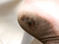 Feet - Tatiana - 2011-07-23 Something about dirty feet