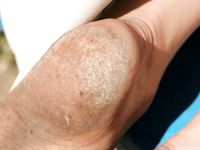 Feet - Tatiana - 2011-07-23 Something about dirty feet