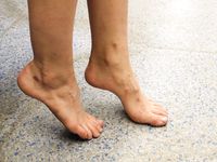 Feet - Valeria C - 2017-08-20 A barefoot trip