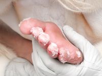 Feet - Valya - 2007-06-15 Hot feet and cold snow