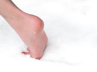 Feet - Valya - 2007-06-15 Hot feet and cold snow