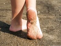 Feet - Vera - 2018-03-31 A spring barefoot stroll