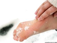 Feet - Victoria - 2013-06-12 Barefoot in deep fresh snow