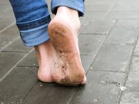 Feet - Victoria B - 2016-07-29 Barefoot in the snowy street