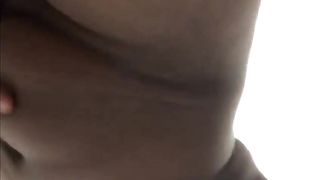 Areolas