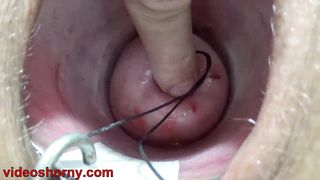 Uterus Penetration with Japanese objects, Pumping Cervix Prolapse