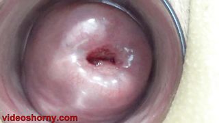 Uterus Penetration with Japanese objects, Pumping Cervix Prolapse