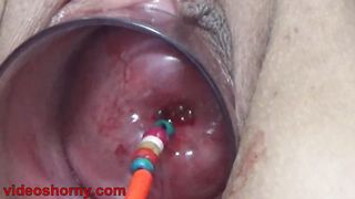 Uterus Penetration with Japanese objects, Pumping Cervix Prolapse