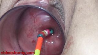 Uterus Penetration with Japanese objects, Pumping Cervix Prolapse