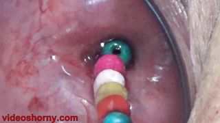 Uterus Penetration with Japanese objects, Pumping Cervix Prolapse