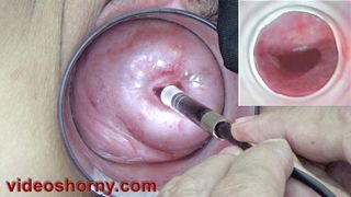 Japanese Endoscope Camera inside Cervix Cam into Pussy