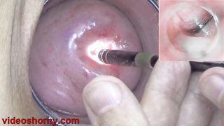 Japanese Endoscope Camera inside Cervix Cam into Pussy