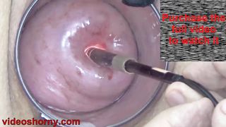 Japanese Endoscope Camera inside Cervix Cam into Pussy