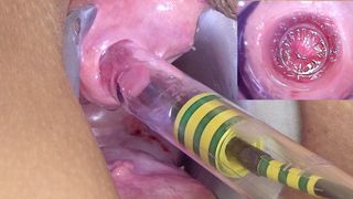 Woman Pee Hole Playing, Urethral Insertion with Endoscope Cam