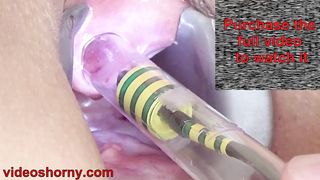 Woman Pee Hole Playing, Urethral Insertion with Endoscope Cam