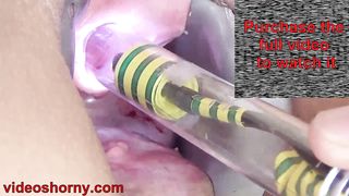 Woman Pee Hole Playing, Urethral Insertion with Endoscope Cam