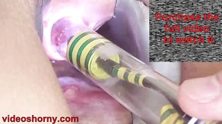 Woman Pee Hole Playing, Urethral Insertion with Endoscope Cam
